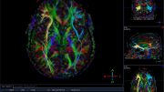 脑扫描神经科学概念