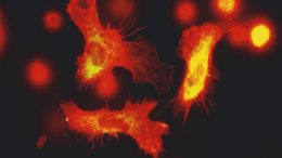 免疫细胞荧光显微镜