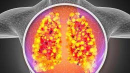 肺呼吸系统感染
