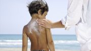 保护孩子们立即皮肤预防癌症