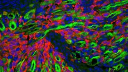 研究人员发现了引起横纹肌肉瘤的细胞类型