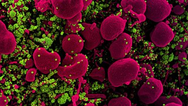 SARS-COV-2病毒彩色扫描电子显微镜