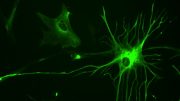 星形胶质细胞帮助大脑对视觉刺激做出反应